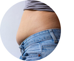 Bloating